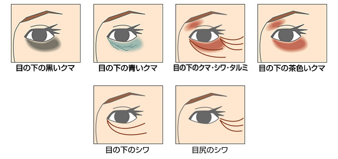 くま 目の下 の 目の下のくまを消したい方の自宅解消法に対する考察